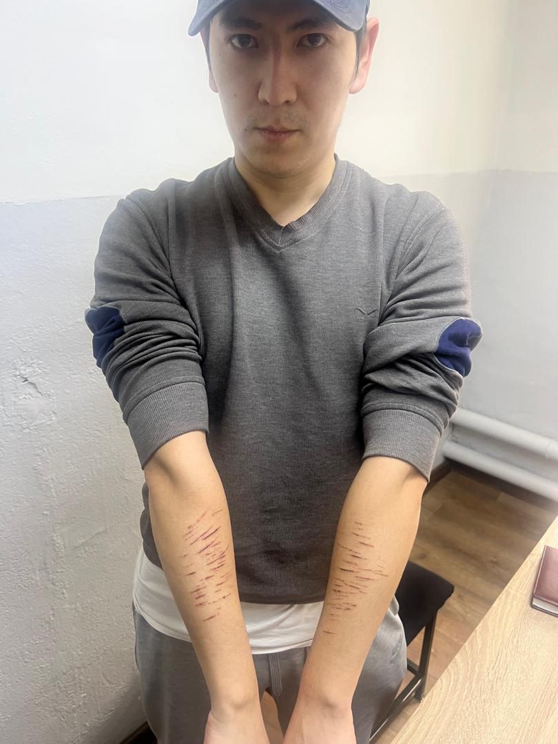 В СИН заявили, что Актилек Капаров «поцарапал» себе руки ручкой